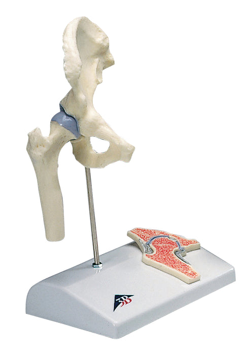 3B Scientific A84/1 Anatomical Model - Mini Hip Joint With Cross Section Of Bone On Base - Includes 3B Smart Anatomy