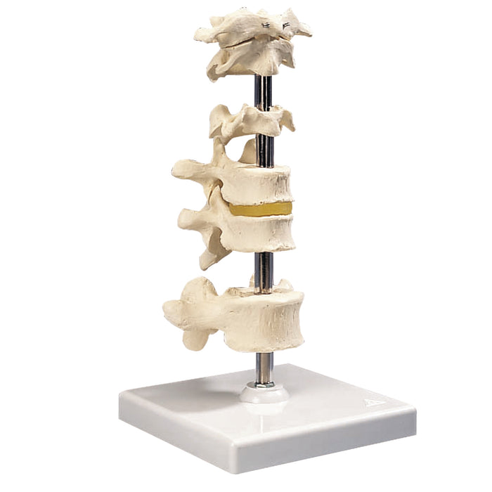 3B Scientific A75 Anatomical Model - 6 Mounted Vertebrae With Removable Stand - Includes 3B Smart Anatomy