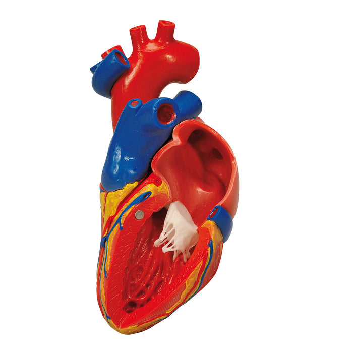 3B Scientific G05 Anatomical Model - Heart With Bypass, 2-Part - Includes 3B Smart Anatomy
