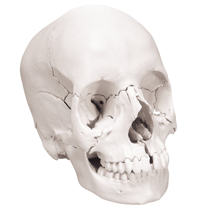 3B Scientific A290 Anatomical Model - Anatomical Skull, Beauchene 22-Part - Includes 3B Smart Anatomy