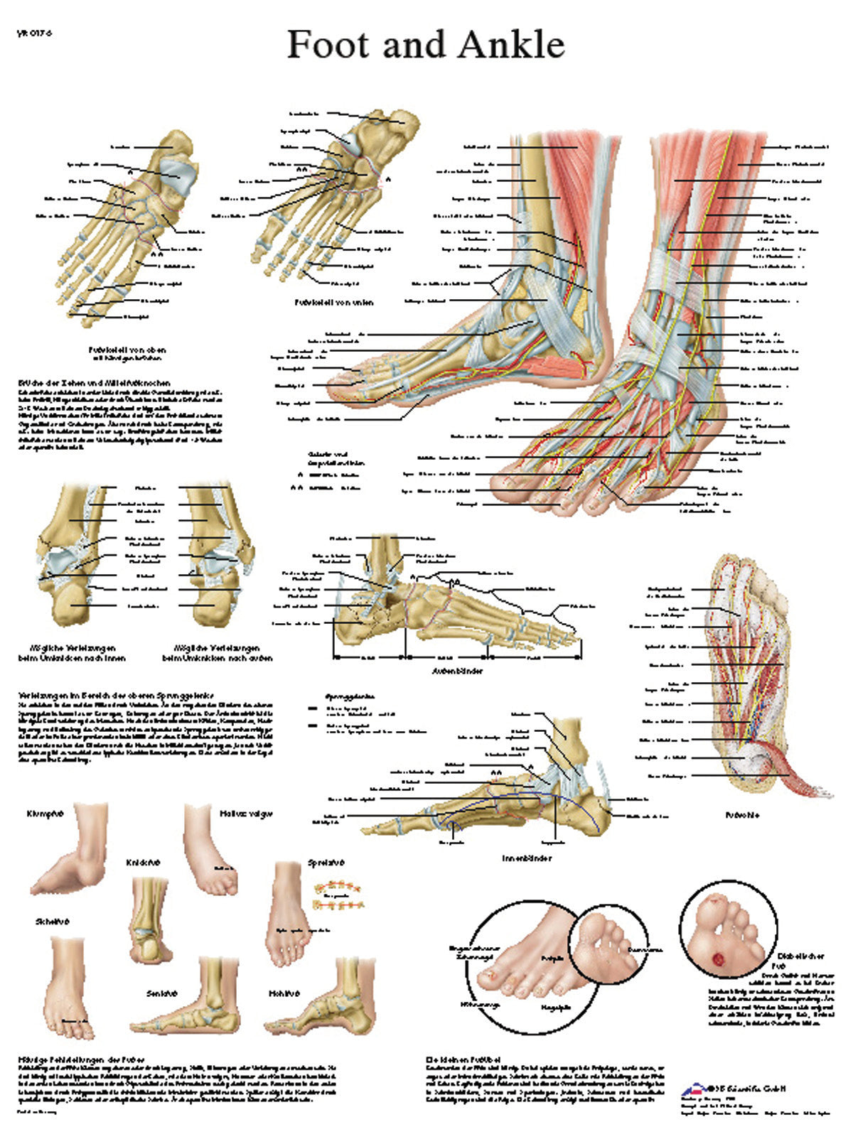 3B Scientific VR1176UU (1-4) Anatomical Chart - Foot & Ankle, Paper ...