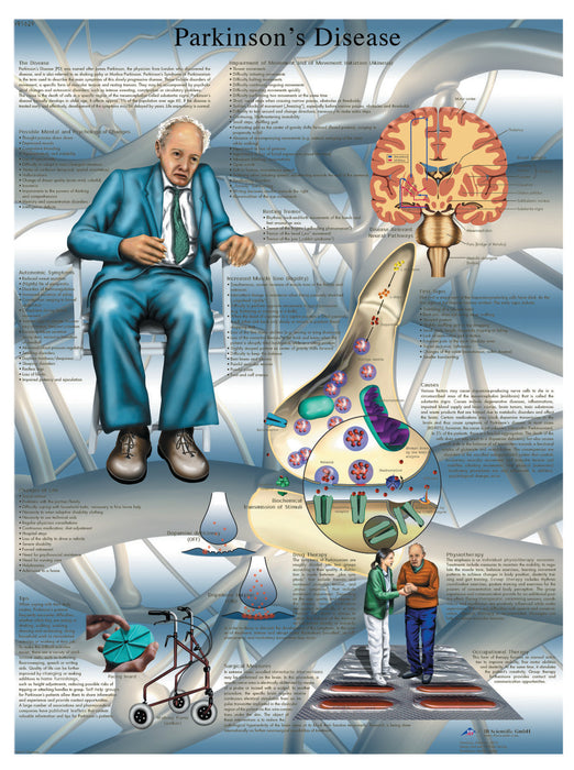 3B Scientific VR1629L (1-4) Anatomical Chart - Parkinson'S Disease, Laminated