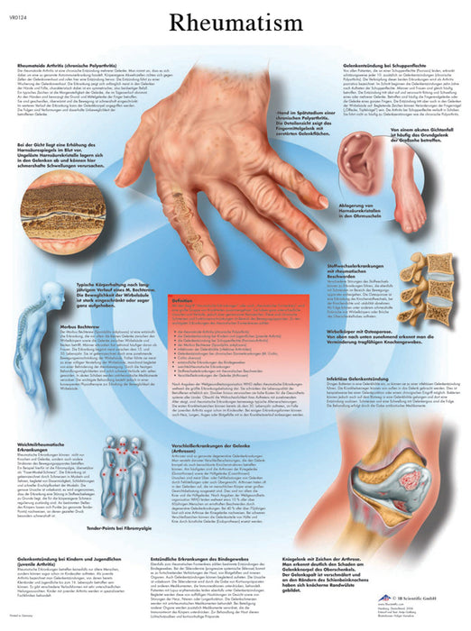 3B Scientific VR1124UU (1-4) Anatomical Chart - Rheumatic Diseases, Paper