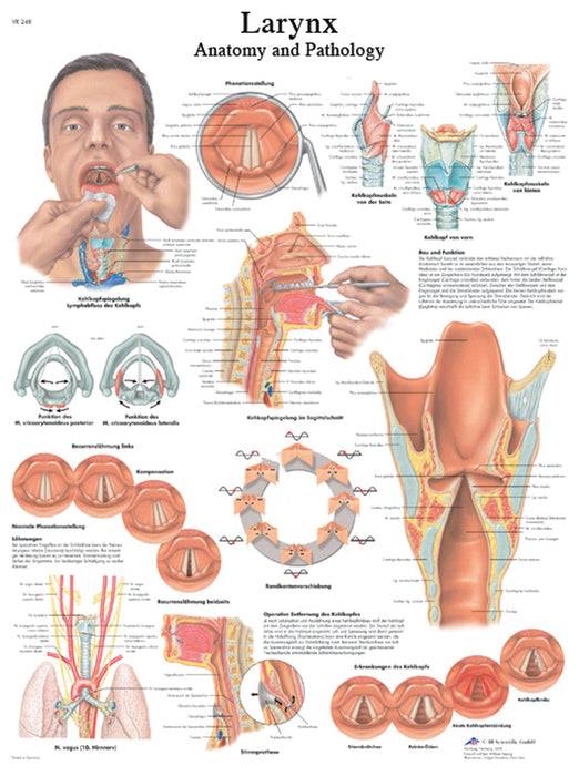 3B Scientific VR1248L Anatomical Chart - Larynx, Laminated