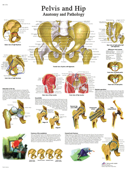 3B Scientific VR1172UU (1-4) Anatomical Chart - Hip & Pelvis, Paper